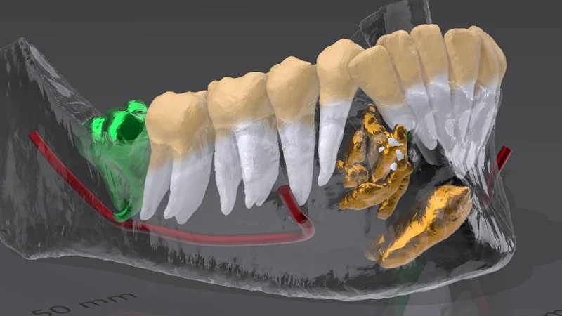 Imagem do serviço Impressão 3D Odontológica